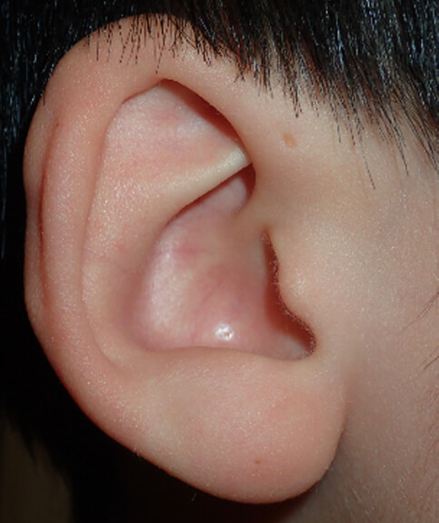 耳の前に小さな穴があります。
